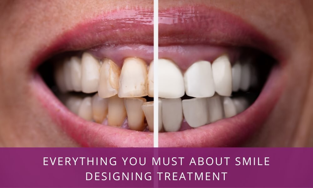 Smile Designing & Cosmetic Dentistry