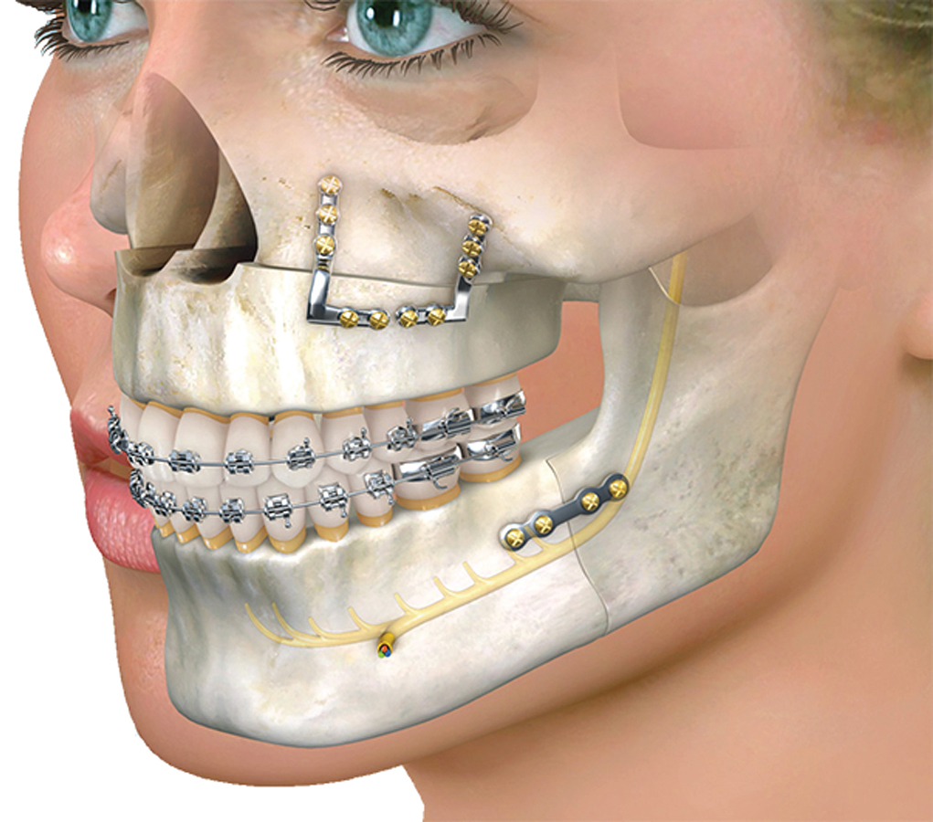 Oral & Maxillofacial Surgery