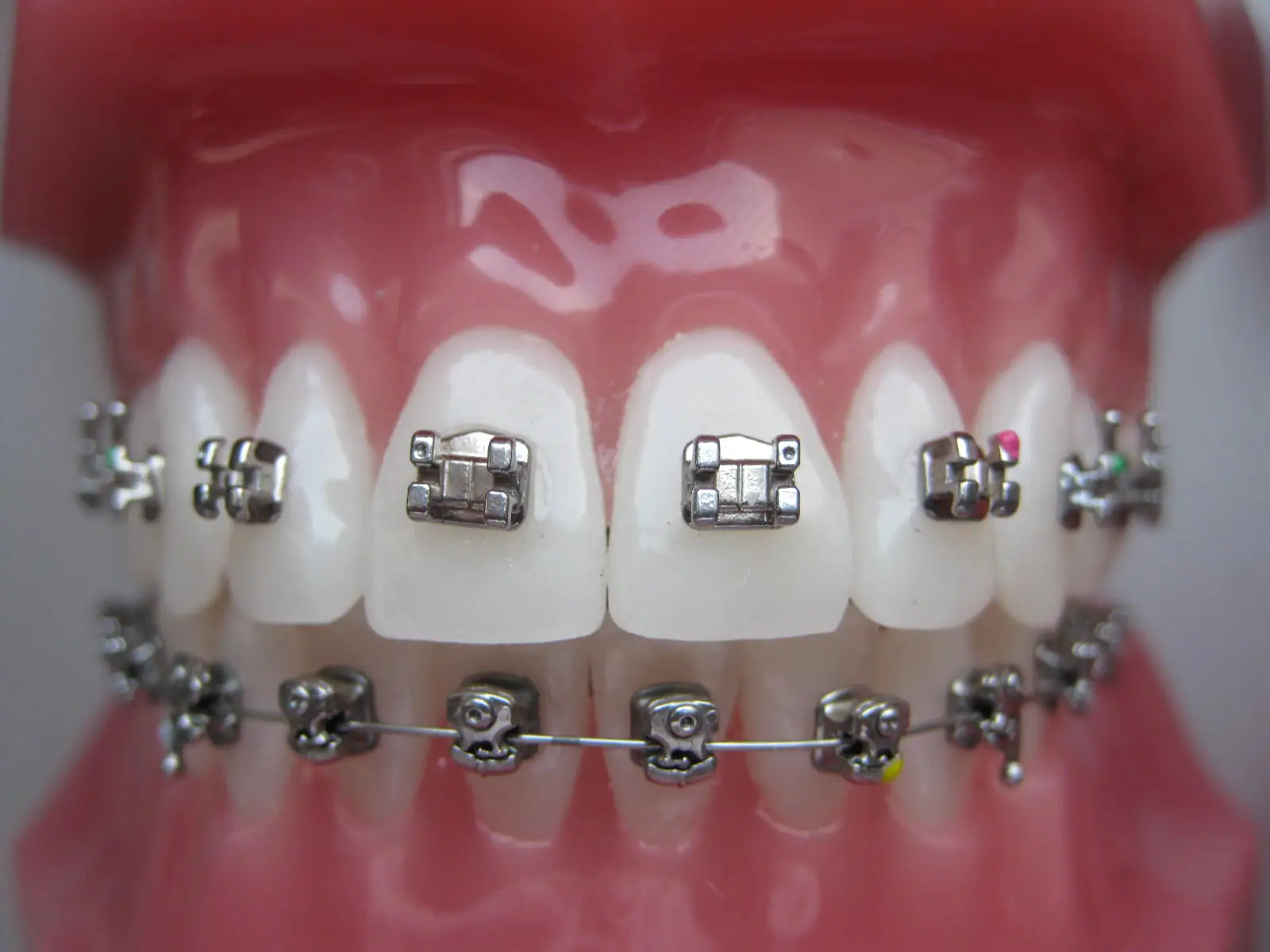 Orthodontics